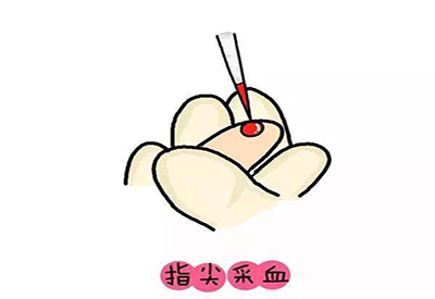 儿童樱桃视频在线播放微量元素的检测项目有哪些 儿童樱桃视频在线播放微量元素的检测项目有哪些